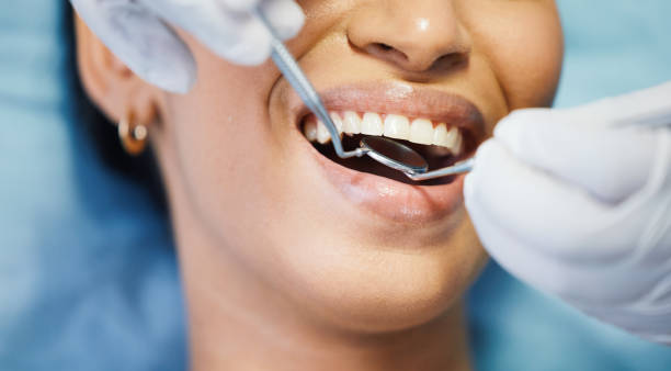 Best Affordable Emergency Dental Care  in Monterey, CA