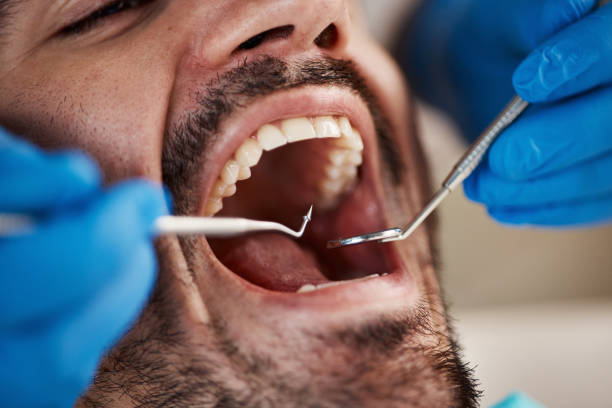 Best Affordable Emergency Dental Care  in Monterey, CA