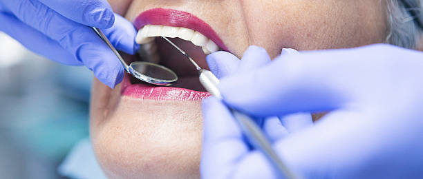 Best Chipped Tooth Repair Near Me  in Monterey, CA
